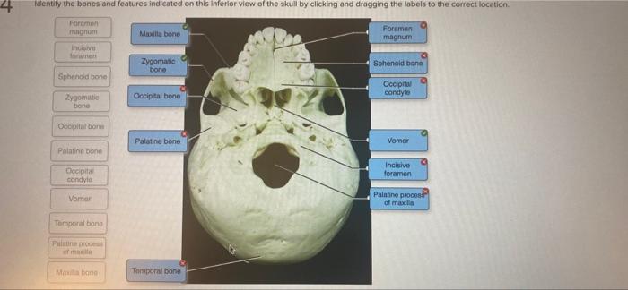 sphenoid bone inferior view