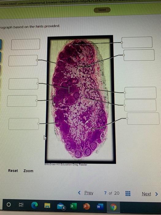 Solved Label The Photomicrograph Based On The Hints | Chegg.com