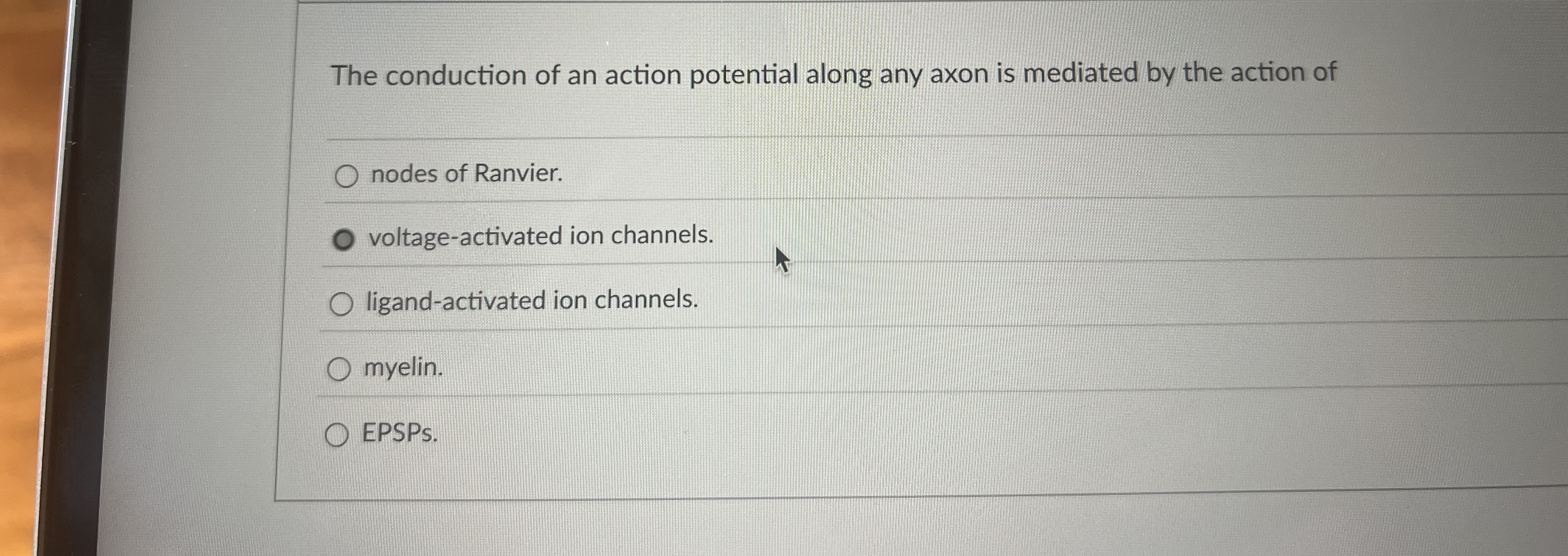 Solved The conduction of an action potential along any axon | Chegg.com