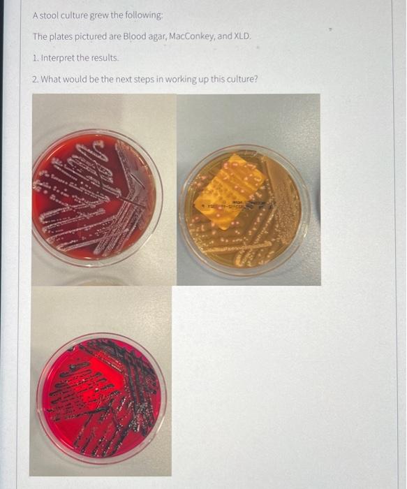 A stool culture grew the following:
The plates pictured are Blood agar, MacConkey, and XLD.
1. Interpret the results.
2. What