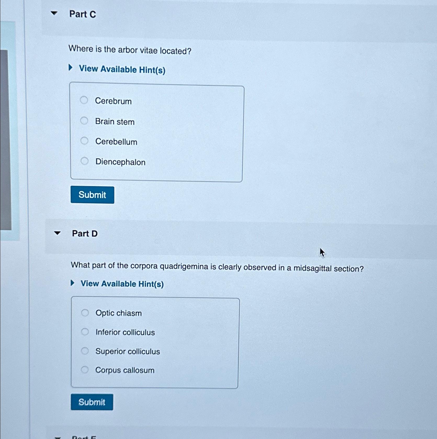 Solved Part CWhere is the arbor vitae located?View Available
