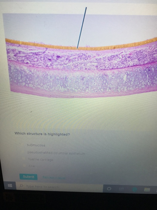 Solved 1. Submucosa 2. Pseudostratified columnar epithelium | Chegg.com