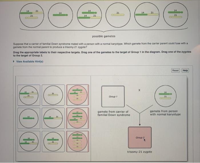 Solved Down syndrome is caused by trisomy 21, the presence