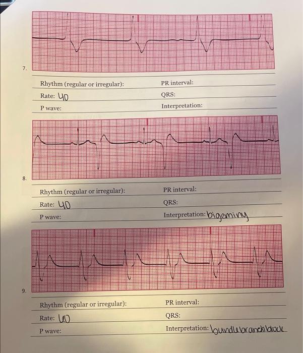 7. PR interval: Rhythm (regular or irregular): Rate: | Chegg.com