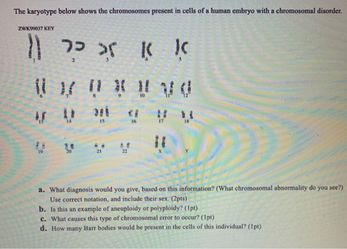 Solved The karyotype below shows the chromosomes present in | Chegg.com