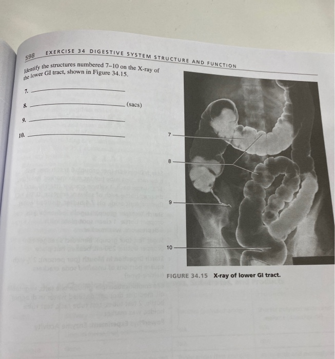 Solved EXERCISE 34 DIGESTIVE SYSTEM STRUCTURE AND FUNCTION