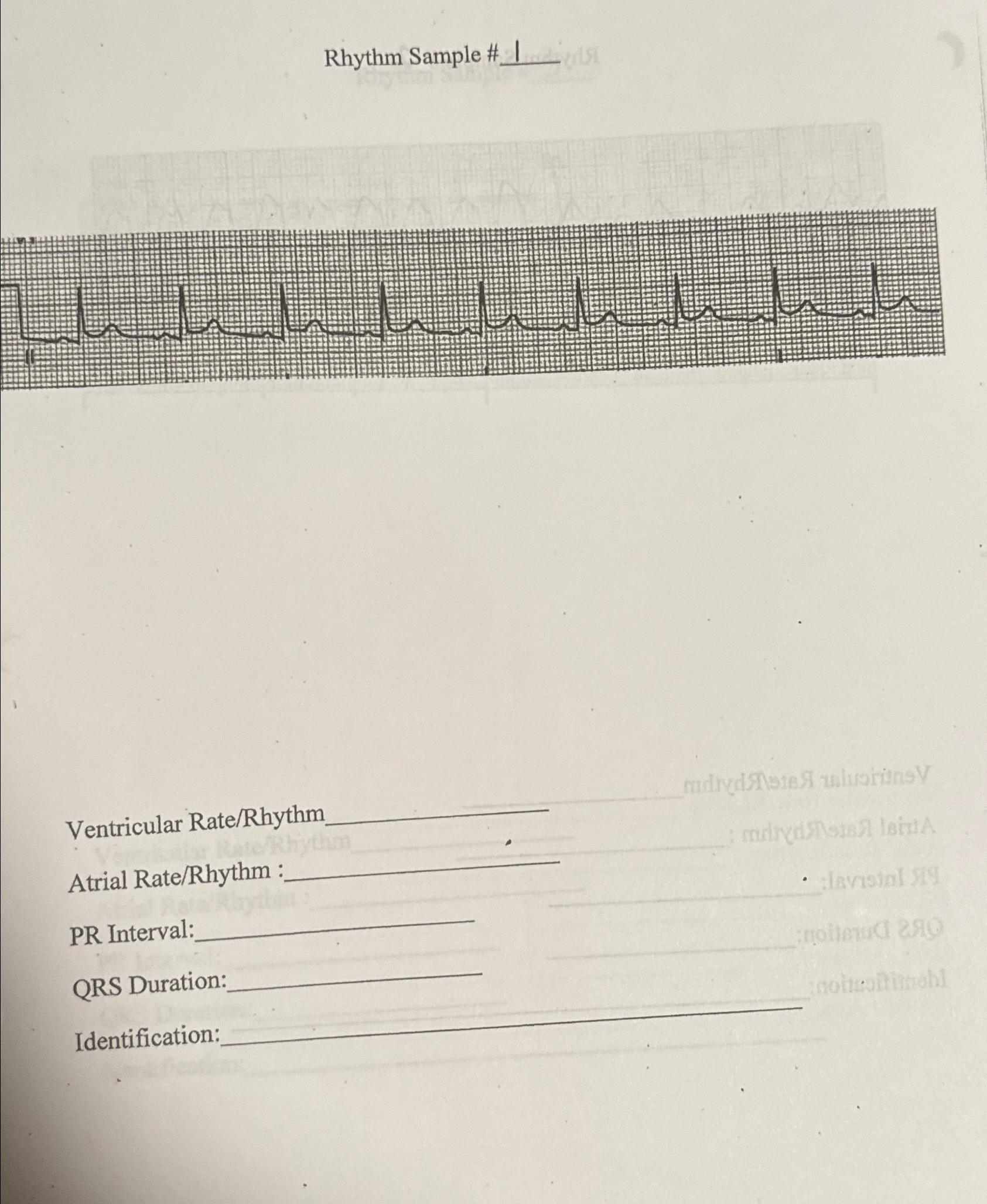 Solved Rhythm Sample #Ventricular Rate/RhythmAtrial | Chegg.com