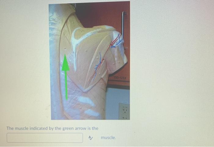 The muscle indicated by the green arrow is the A/ muscle.