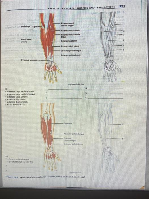 Solved 223 EXERCISE 10 SKELETAL MUSCLES AND THEIR ACTIONS | Chegg.com