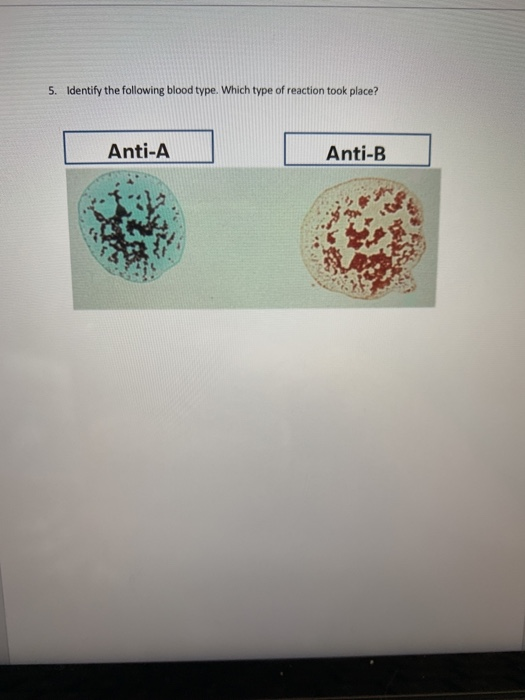 Solved 5. Identify The Following Blood Type. Which Type Of | Chegg.com