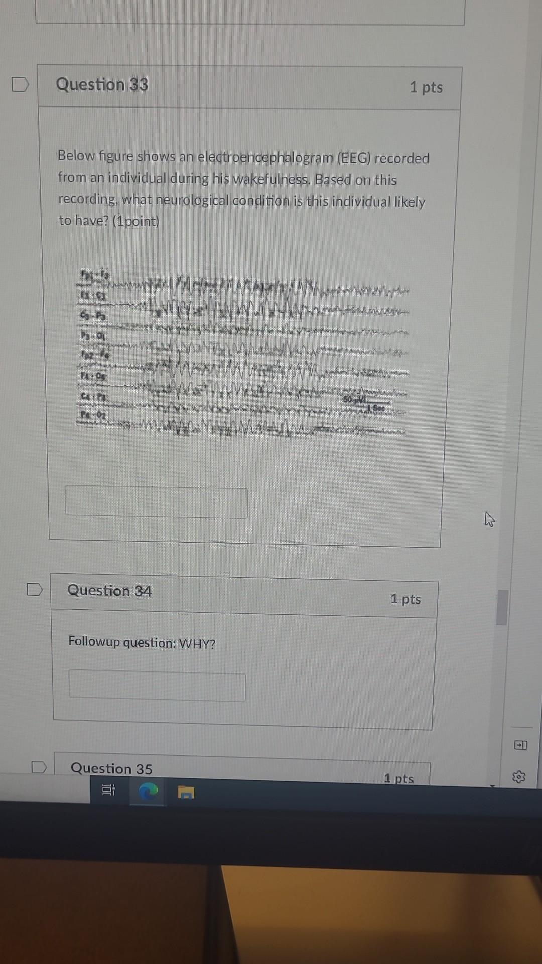 Solved Below Figure Shows An Electroencephalogram (EEG) | Chegg.com