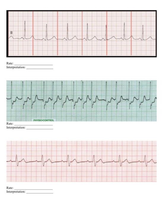 Solved please help me find the rate and type of rhythm i | Chegg.com