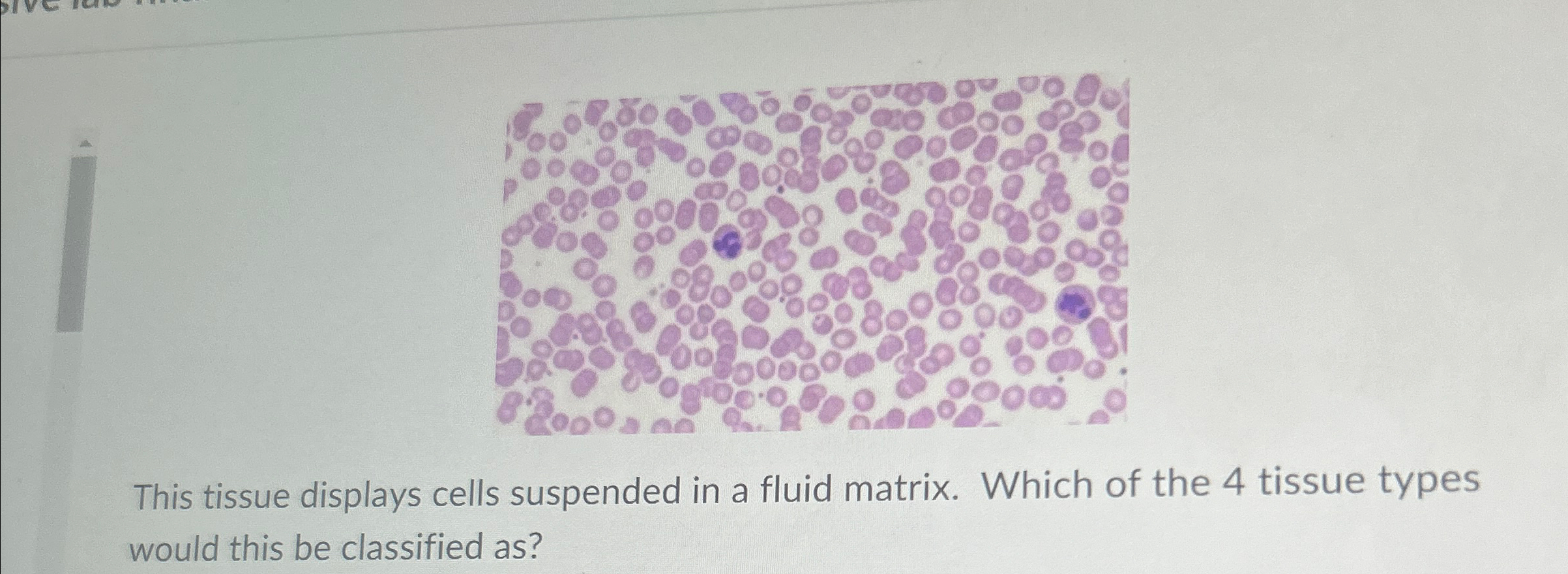 Solved This tissue displays cells suspended in a fluid | Chegg.com