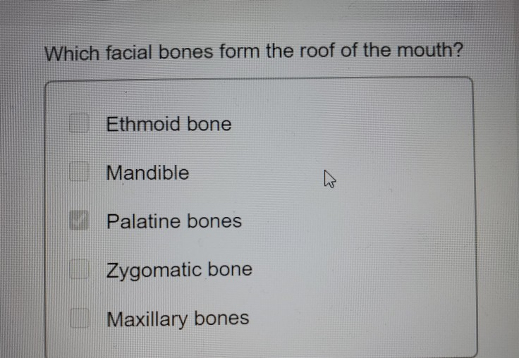 Solved Which facial bones form the roof of the mouth? | Chegg.com