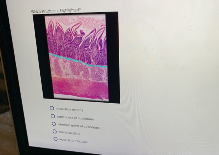 Solved Which Structure Is Highlighted? O Muscularis Externa 