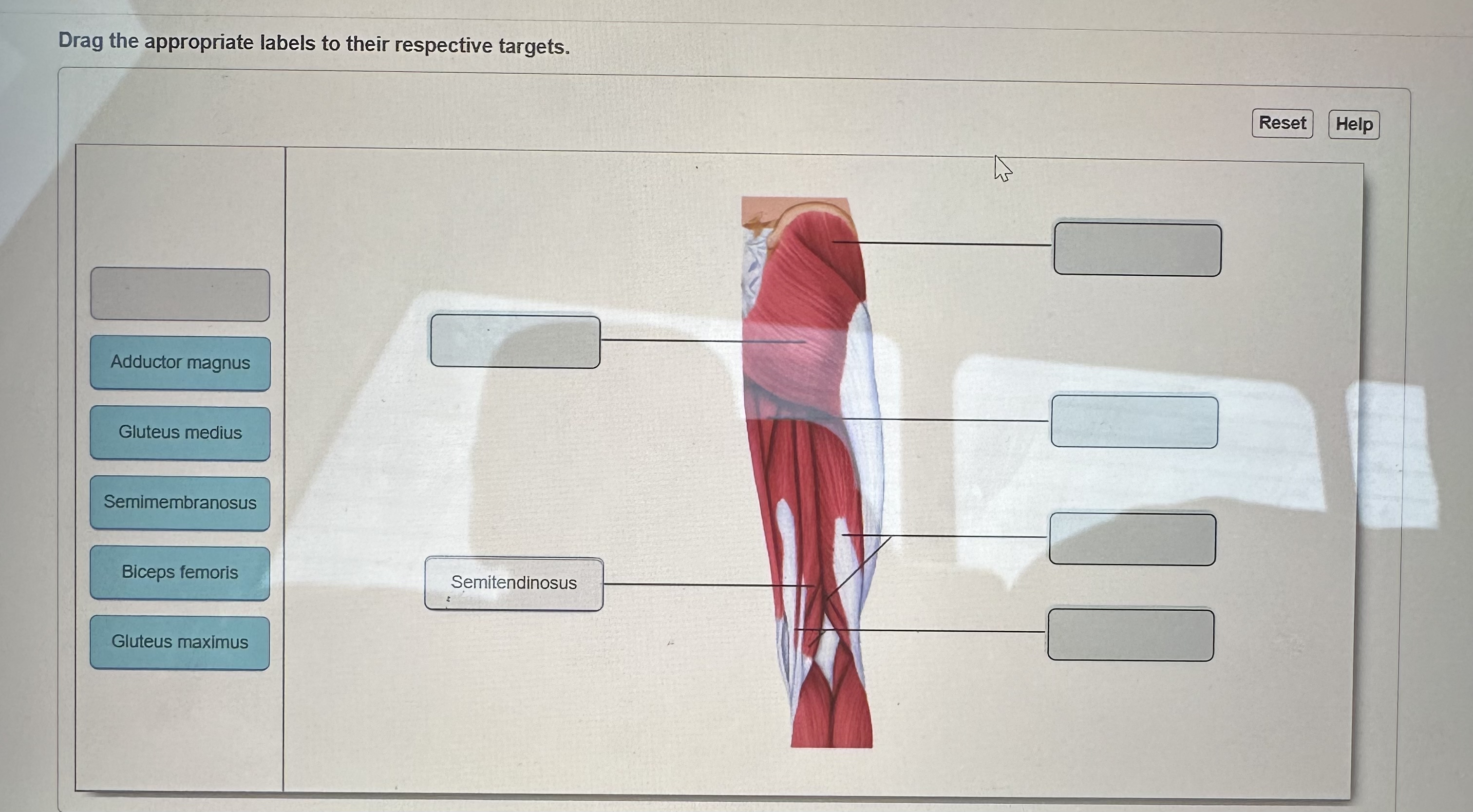 Dedrag The Appropriate Labels To Their Respective Targets. Chegg - 2sy9w75