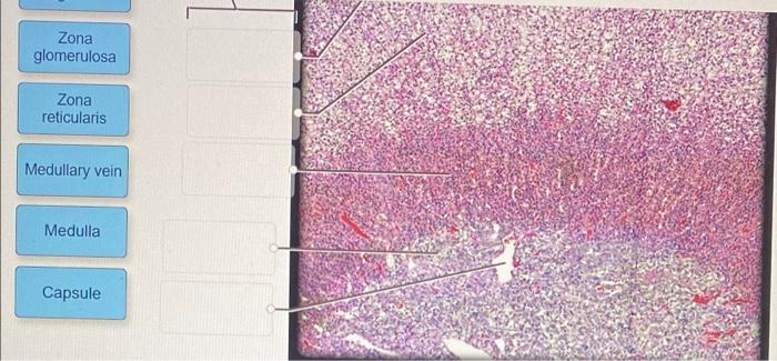 Solved Label the photomicrograph based on the hints | Chegg.com