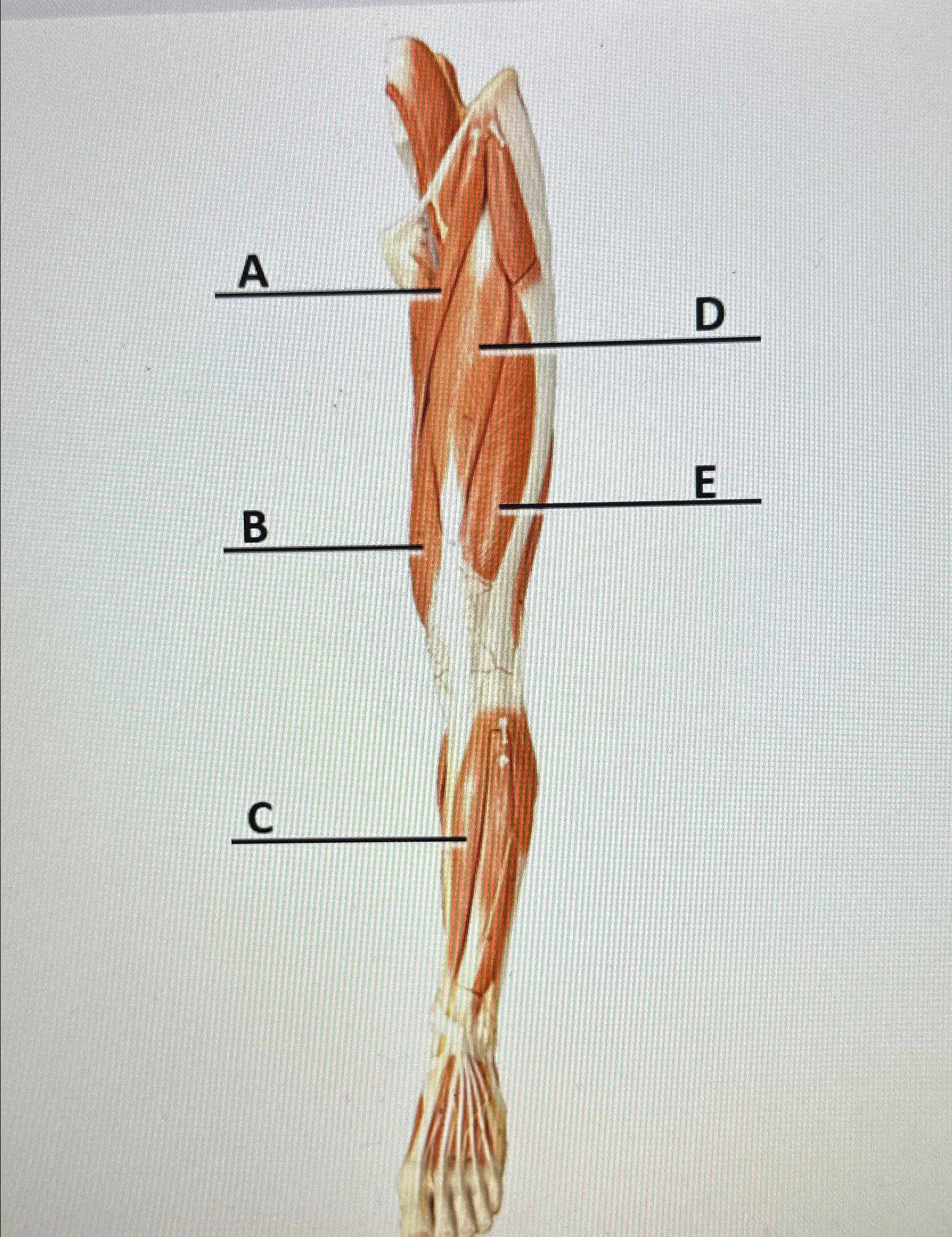 Solved Label the muscles in the leg | Chegg.com