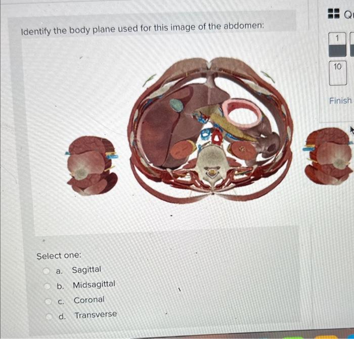 Identify the body plane used for this image of the abdomen:
Select one:
a. Sagittal
b. Midsagittal
c. Coronal
d. Transverse