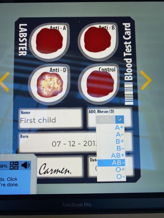 Solved Anti-A Inti-B LABSTER Blood Test Card Anti-D Control | Chegg.com