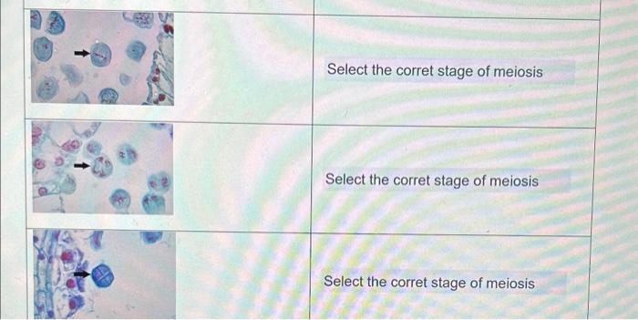 Solved Identify the stages of meiosis: Image Stage Select | Chegg.com