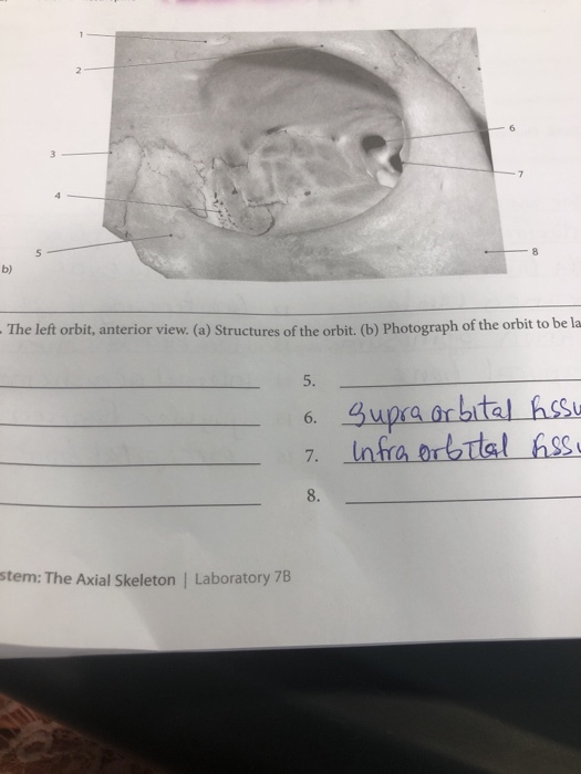Solved - The left orbit, anterior view. (a) Structures of | Chegg.com