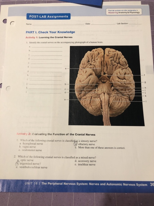 Label Cranial Nerves Quiz