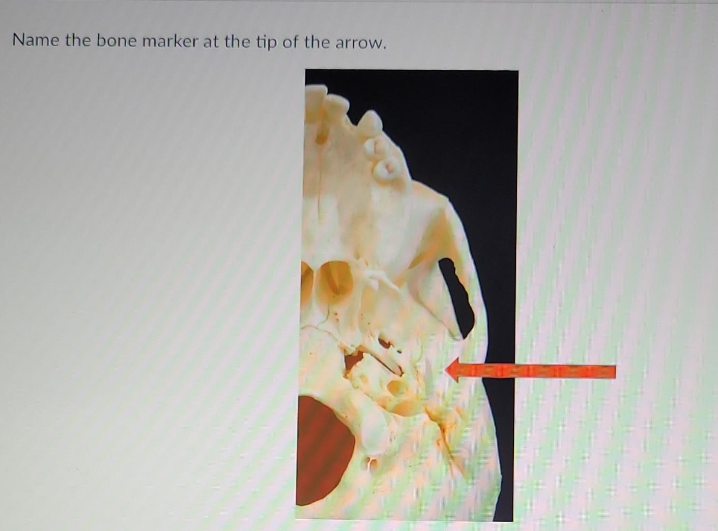 Tip Bone Solved Name the bone marker at the tip of the arrow. Name | Chegg.com