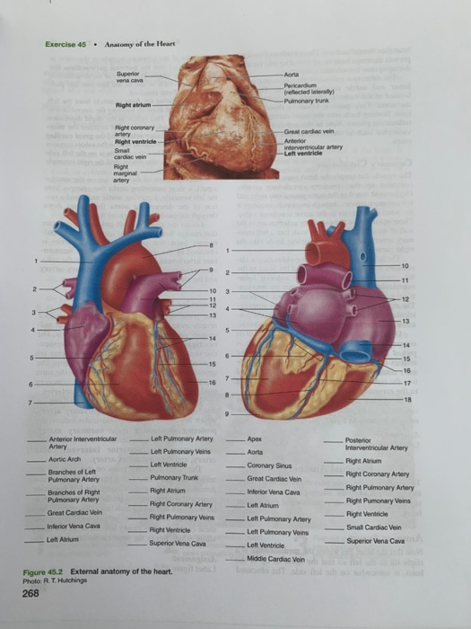 Exercise 45 Anatomy Of The Heart Superior Aorta Chegg Com