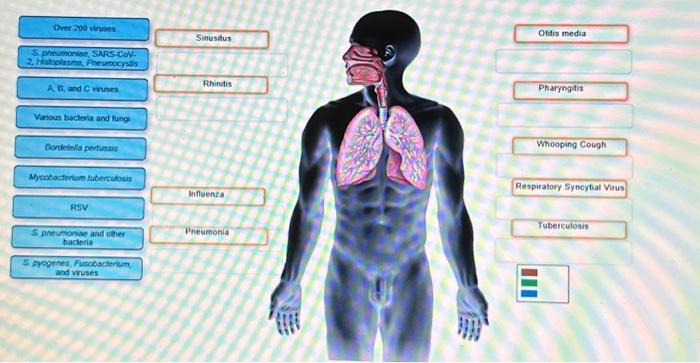 Solved Spectrum of Respiratory System Infections Label the | Chegg.com
