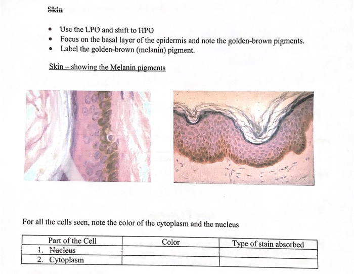 Lpo Microscope Example Solved • Use the LPO and shift to HPO • Focus on the basal | Chegg.com