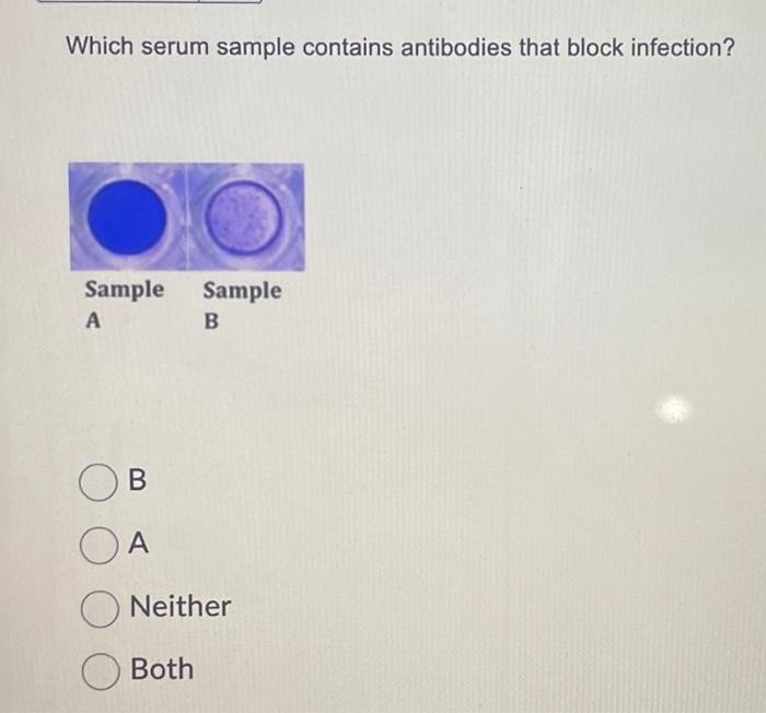Solved Which serum sample contains antibodies that block