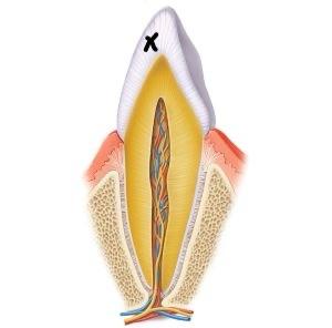 Solved Identify the part of the tooth marked with an X in | Chegg.com