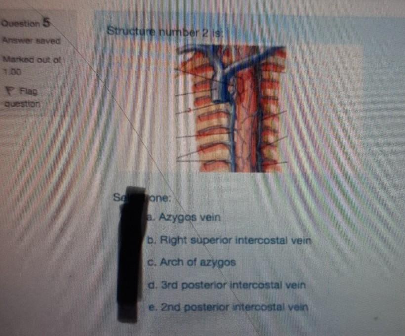 superior intercostal vein