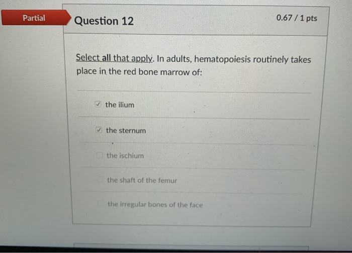 Solved Partial Question 12 0.67 / 1 pts Select all that | Chegg.com