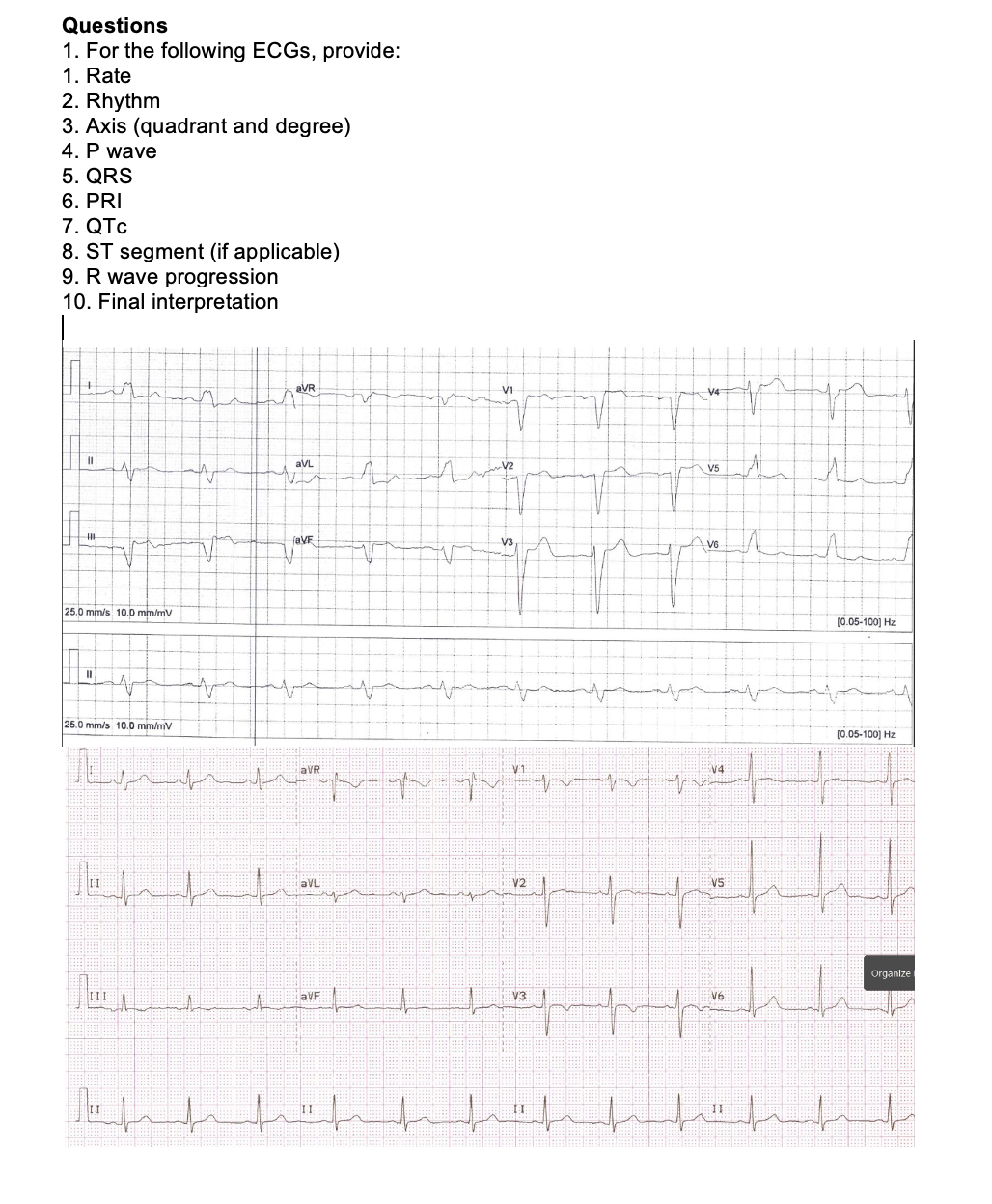 Solved Questions1. ﻿For the following ECGs, provide:1. | Chegg.com