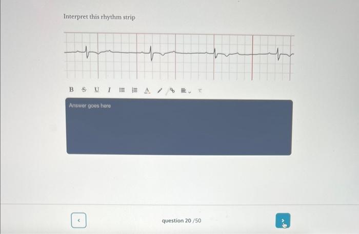 Solved Interpret This Rhythm Strip Interpret This Rhythm | Chegg.com