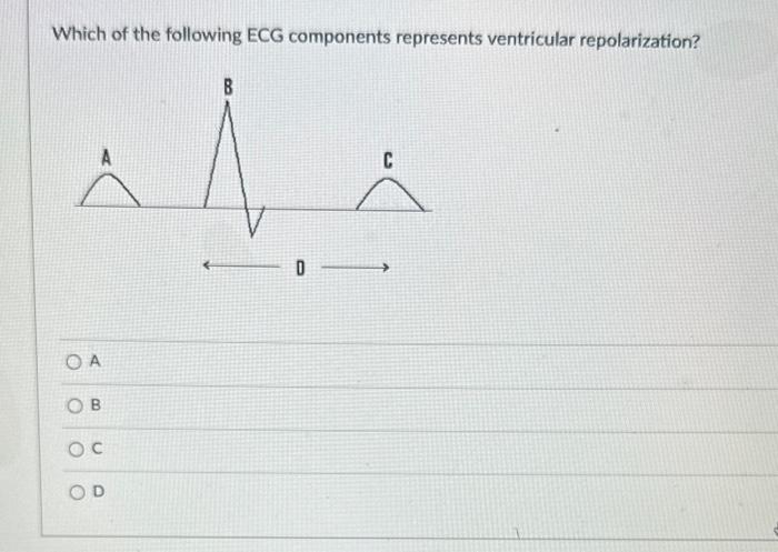 Solved Which of the following ECG components represents | Chegg.com