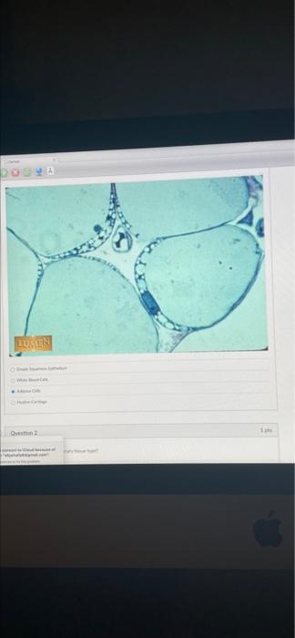 Solved x Y LUSEN Question Which type of tissue is this | Chegg.com
