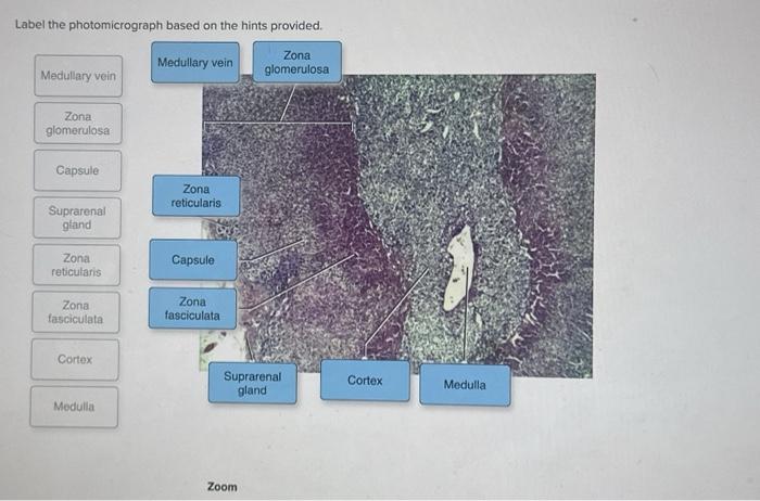 Solved Label the photomicrograph based on the hints | Chegg.com