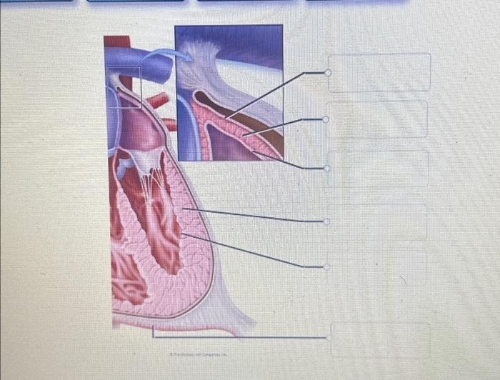 Solved Identify the layers of the heart wall and surrounding