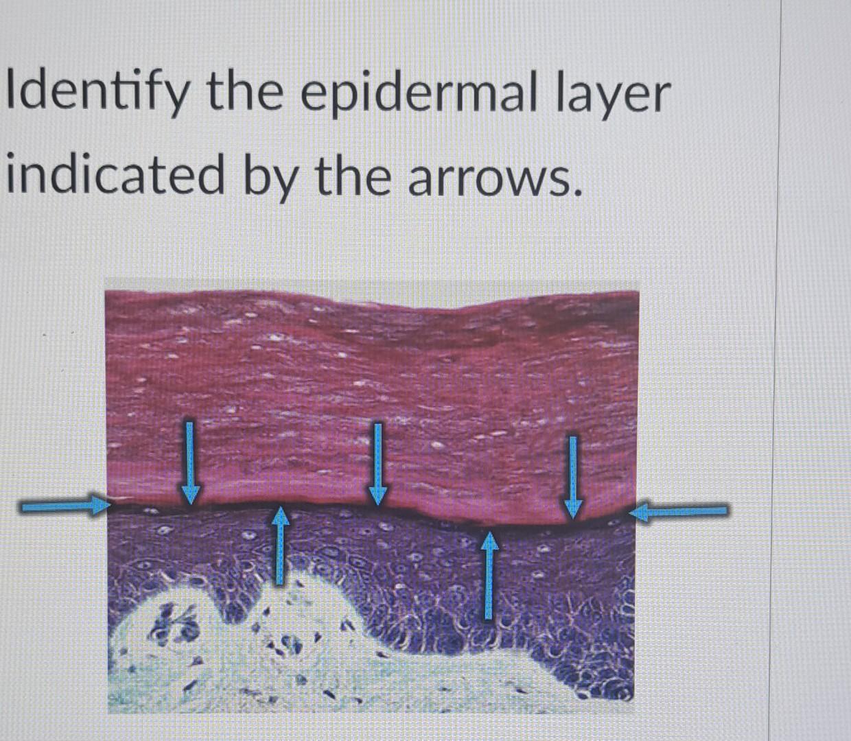 Solved Identify the epidermal layer indicated by the arrows. | Chegg.com