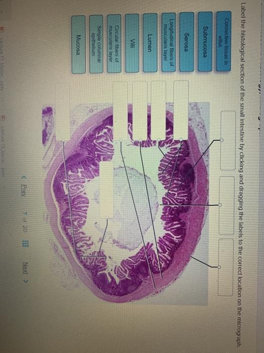 Solved Label the histological section of the small intestine | Chegg.com