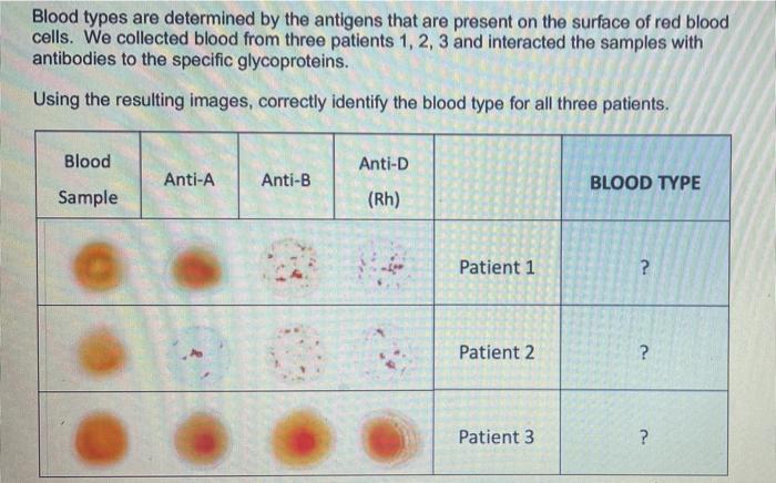 Solved Blood types are determined by the antigens that are | Chegg.com