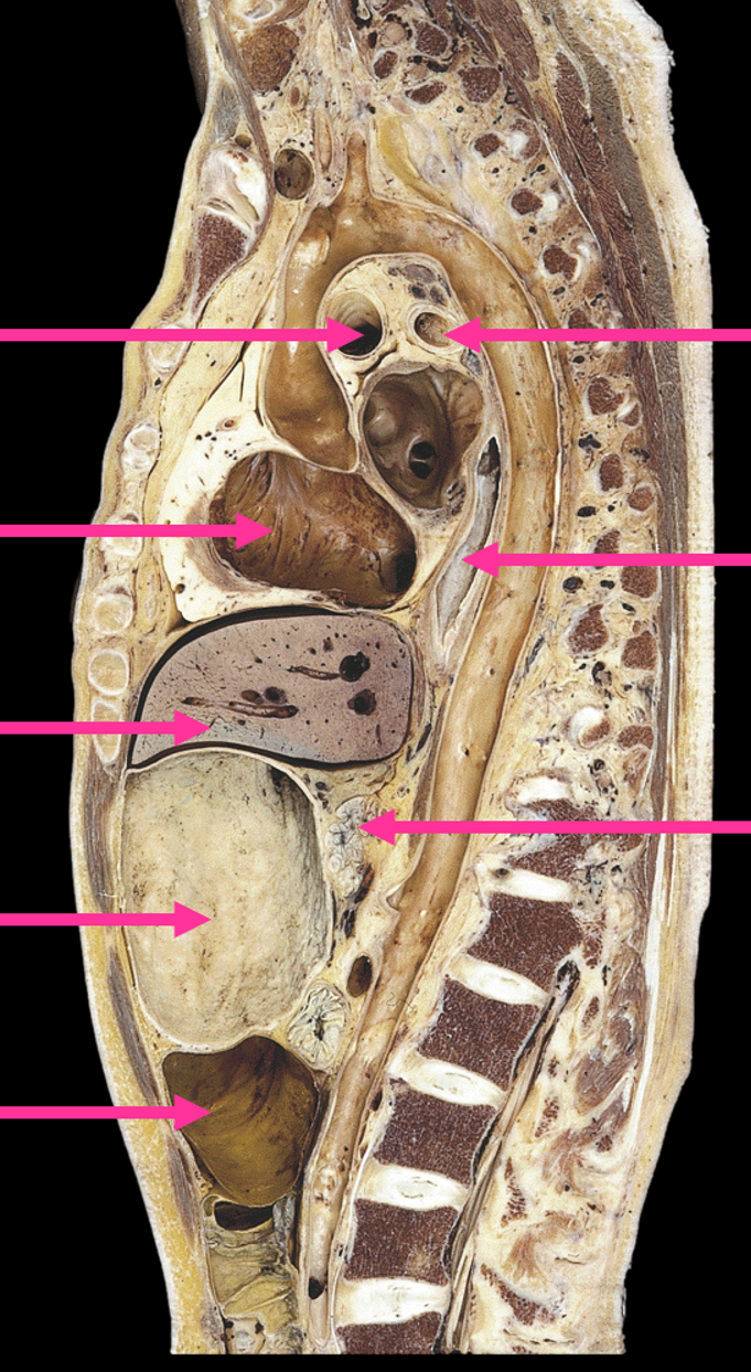 Solved anatomy of thorax sagital section | Chegg.com