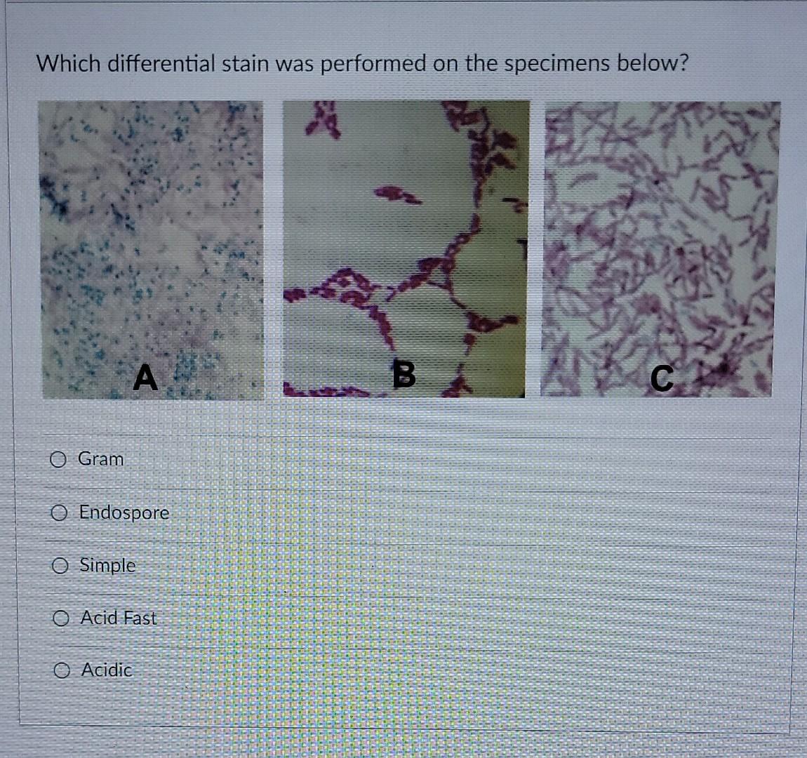 Solved Which differential stain was performed on the | Chegg.com