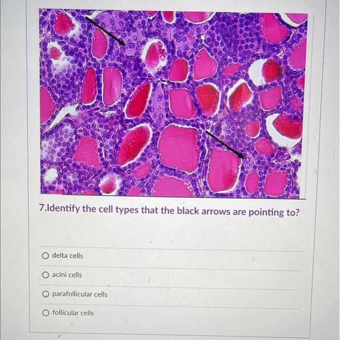 Solved 7.Identify the cell types that the black arrows are | Chegg.com
