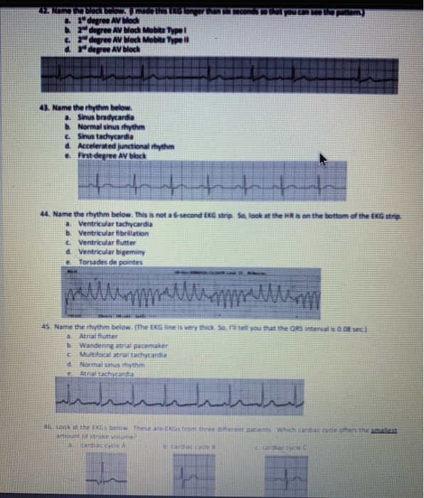Made This Ename Block Mobits Typel Av Block Mobite Chegg Com