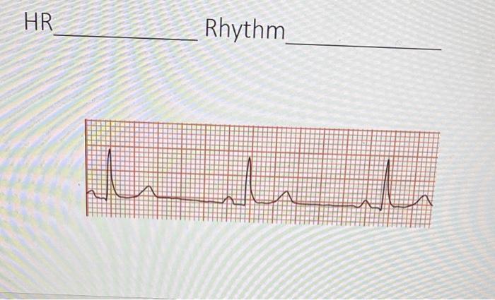 Solved HR RhythmHR RhythmHR Rhythm | Chegg.com