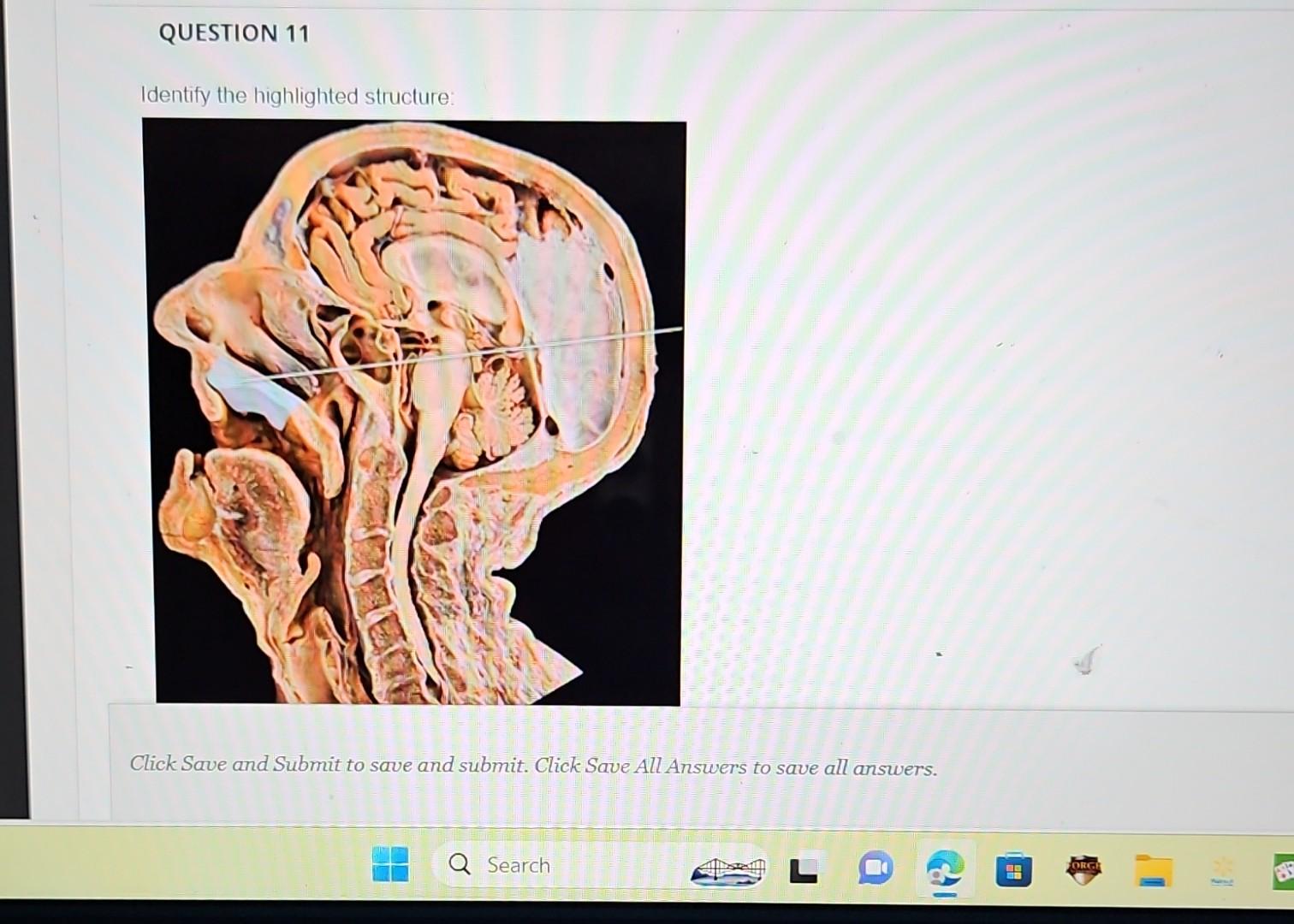 Solved Identify the highlighted structure: Click Save and | Chegg.com